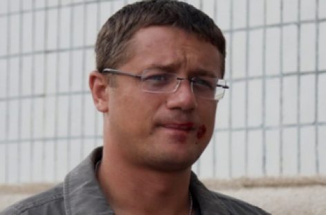 Алексей Макаров пострадал во время неудачного трюка на съемочной площадке