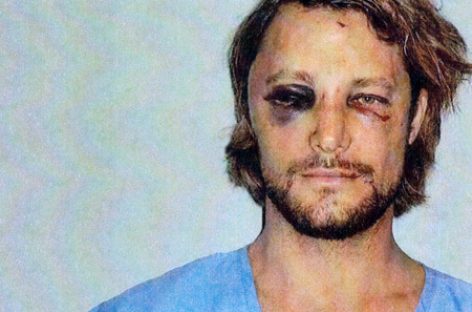 Фотографии избитого бывшего мужа Холли Берри попали в интернет