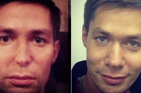 Стас Пьеха переделал себе нос?