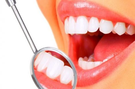 Готовимся к имплантации зубов: что нужно знать пациенту?